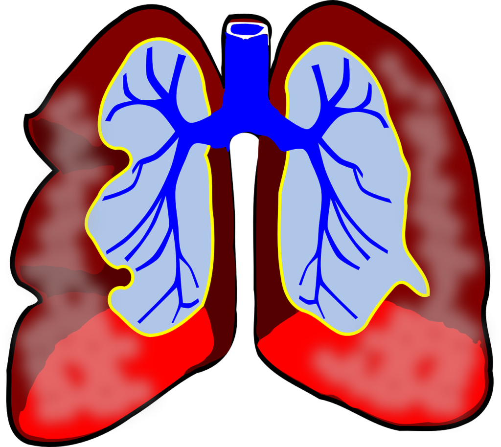 lungs, human, diagram-39981.jpg